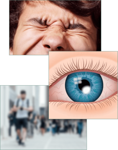 collage of photos of what a corneal infection looks like-eye pain, white spot on cornea, and blurry vision 