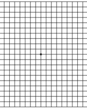 Amsler Grid